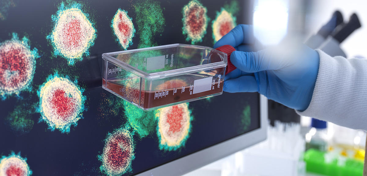 Madárinfluenza: Újabb pandémia a láthatáron?